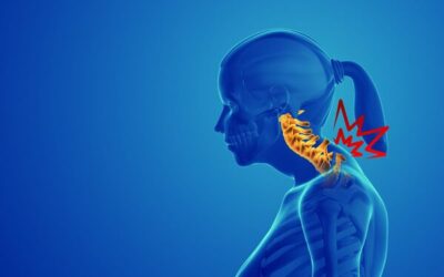 Cyphose, bosse de bison, dos arrondi : comprendre, prévenir et corriger grâce au sport adapté