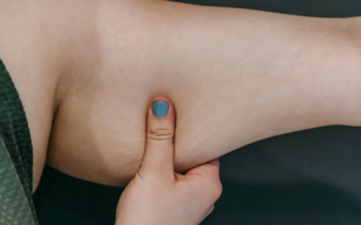 Combattre l’effet « aile de chauve-souris » : comment raffermir efficacement le dessous des bras