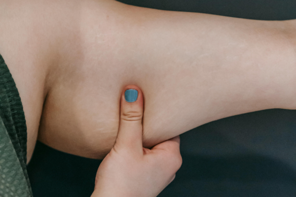 un bras de femme dont le dessous est détendu comme une aile de chauve souris